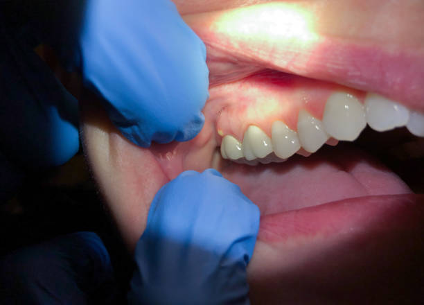  Langhorne Manor, PA Emergency Dentist Pros